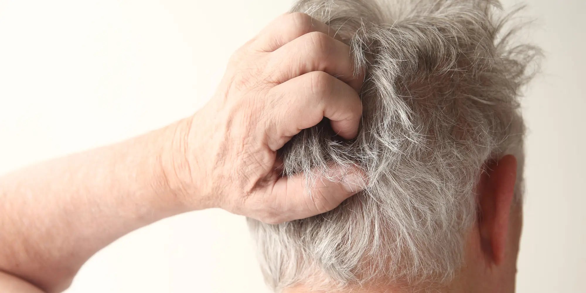 Do Hair Building Fibers Work Elite Hair Fibers Do Hair Building Fibers Work Elite Hair Fibers